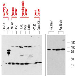 Western blot analysis of normal rat tissue (right) and in human cancer cell lines (left): p75NTR is visualized with Anti-Human p75NTR (extracellular) antibody (#AG1417), (1:200). Note that human cancer cell lines from hemapoietic origin show high p75NTR expression, while cell lines from prostate and colon cancer origin show lower levels. Interestingly, p75NTR from rat (right blot and the C6 cell line) and human (left blot) samples run with a different apparent MW, probably due to species-specific differential glycosylation.