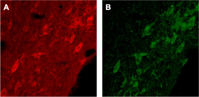 Expression of p75NTR in rat brain Immunohistochemical staining of rat brain with Anti-Human p75NTR (extracellular) antibody (#AG1417). A. Cells in the diagonal band are stained positive for p75NTR. B. Staining of the same section with goat anti-ChAT confirms that p75NTR staining is specific to cholinergic neurons.
