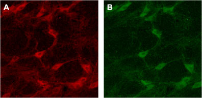 Expression of p75NTR in rat brain Immunohistochemical staining of rat brain with Anti-Human p75NTR (extracellular) antibody (#AG1417). A. Cells in the nucleus basalis mangocellularis are stained positive for p75NTR. B. Staining of the same section with goat anti-ChAT confirms that the p75NTR staining is specific to cholinergic neurons.