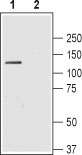 Western blot analysis of rat brain lysate: 1. Anti-NBCe1 (extracellular) antibody (#AG1415), (1:200). 2. Anti-NBCe1 (extracellular) antibody, preincubated with the control peptide antigen.