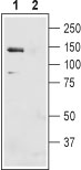 Western blot analysis of mouse liver membranes: 1. Anti-NBCe1 (extracellular) antibody (#AG1415), (1:400). 2. Anti-NBCe1 (extracellular) antibody, preincubated with the control peptide antigen.
