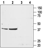 Western blot analysis of rat liver (lanes 1 and 3) and rat kidney (lanes 2 and 4) membranes: 1, 2. Anti-Angiotensin II Receptor Type-1 (extracellular) antibody (AG1463), (1:200). 3, 4. Anti-Angiotensin II Receptor Type-1 (extracellular) antibody, preincubated with the control peptide antigen.