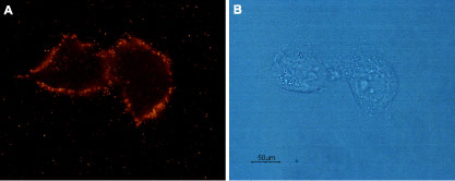 xpression of Angiotensin II Receptor Type-1 in rat C6 glioma cells Immunocytochemical staining of live intact rat C6 glioma cells. A. Cells were stained using Anti-Angiotensin II Receptor Type-1 (extracellular) antibody (#AG1463), (1:100), followed by goat anti-rabbit-AlexaFluor-555 secondary antibody. B. Live intact C6 cells.