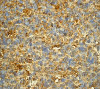 B. Immunohistochemical staining of paraffin-embedded human brain tissue using anti-Mo25 RabMAb (Cat. #AJ1504a).