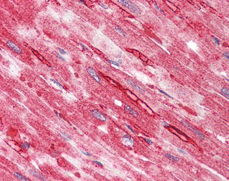 Anti-TTYH2 antibody IHC staining of human heart.