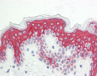 Anti-VPS13B antibody IHC staining of human skin.