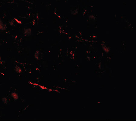 Immunofluorescence of COH1 in human brain tissue with COH1 antibody at 20 ug/ml.
