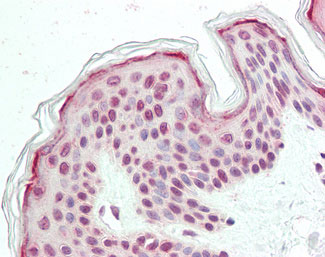 Anti-FAM193B antibody IHC staining of human skin.