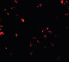Immunofluorescence of FAM193B in Jurkat cells with FAM193B antibody at 20 ug/ml.