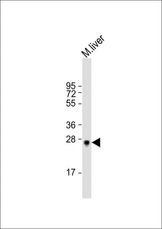 Anti-Sirt3 Antibody (C-term) at 1:2000 dilution + mouse liver lysate Lysates/proteins at 20 µg per lane. Secondary Goat Anti-Rabbit IgG, (H+L), Peroxidase conjugated at 1/10000 dilution. Predicted band size : 37 kDa Blocking/Dilution buffer: 5% NFDM/TBST.