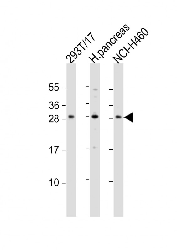 All lanes : Anti-COMTD1 Antibody (C-term) at 1:1000 dilution Lane 1: 293T/17 whole cell lysate Lane 2: human pancreas lysate Lane 3: NCI-H460 whole cell lysate Lysates/proteins at 20 µg per lane. Secondary Goat Anti-Rabbit IgG, (H+L), Peroxidase conjugated at 1/10000 dilution. Predicted band size : 29 kDa Blocking/Dilution buffer: 5% NFDM/TBST.