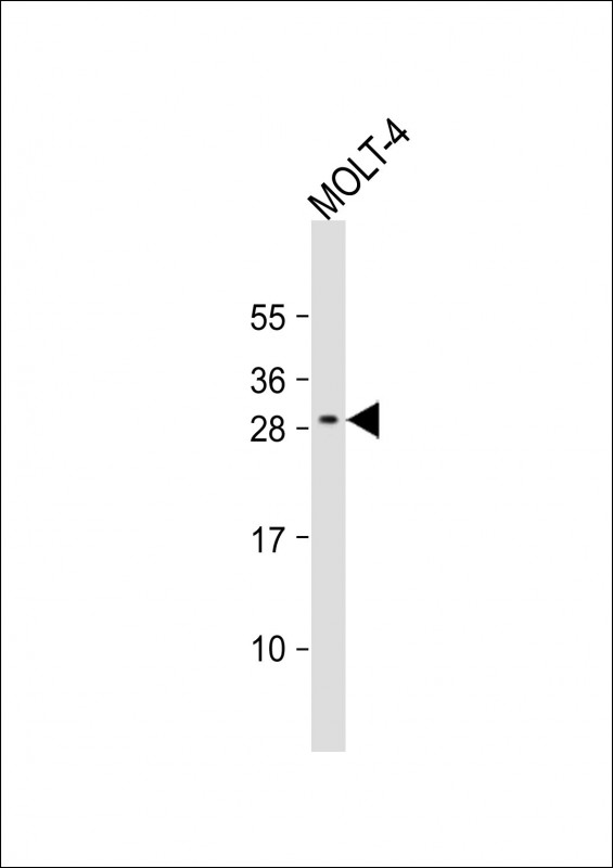 Anti-ALKBH6 Antibody (Center) at 1:1000 dilution + MOLT-4 whole cell lysate Lysates/proteins at 20 µg per lane. Secondary Goat Anti-Rabbit IgG, (H+L), Peroxidase conjugated at 1/10000 dilution. Predicted band size : 26 kDa Blocking/Dilution buffer: 5% NFDM/TBST.