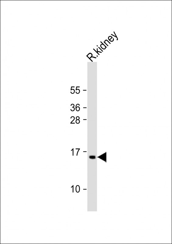 Anti-ATP5G3 Antibody (N-Term) at 1:2000 dilution + rat kidney lysate Lysates/proteins at 20 µg per lane. Secondary Goat Anti-Rabbit IgG, (H+L), Peroxidase conjugated at 1/10000 dilution. Predicted band size : 15 kDa Blocking/Dilution buffer: 5% NFDM/TBST.
