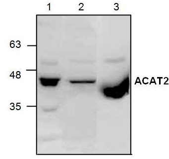 Western blot analysis of ACAT2 using Jurkat cell lysate (Lane 1& 2) and rat kidney tissue lysate Lane 3).