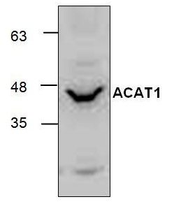 Western blot analysis of ACAT1 with Jurkat cell lysate.