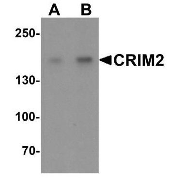 Western blot analysis of CRIM2 in Jurkat cell lysate with CRIM2 antibody at (A) 1 and (B) 2 μg/ml.