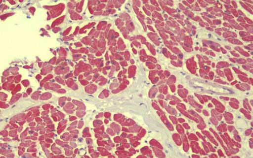 Anti-UHRF1BP1 / ICBP90 antibody IHC staining of human heart.