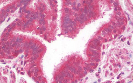 Anti-MTERFD1 antibody IHC staining of human lung.