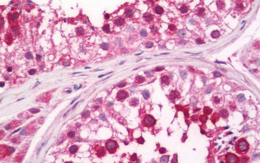 Human Testis: Formalin-Fixed, Paraffin-Embedded (FFPE)