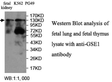 Western Blot analysis of fetal lung and fetal thymus lysate with anti-GSE1 antibody