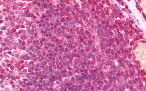 Human Tonsil: Formalin-Fixed, Paraffin-Embedded (FFPE)