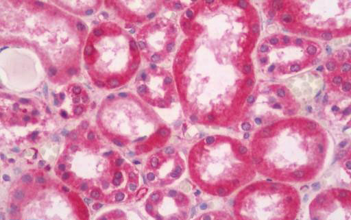 Human Kidney: Formalin-Fixed, Paraffin-Embedded (FFPE)