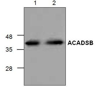 Western blot analysis of ACADSB with Jurkat cell lysate (Lane 1 & 2).