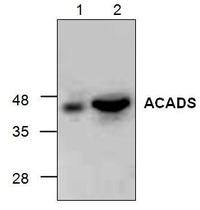 Western blot analysis of ACADSB with mouse 3T3 cell lysate (Lane 1) and rat kidney tissue lysate (Lane 2).