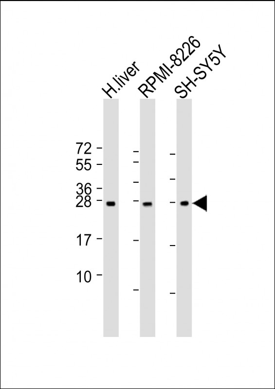 All lanes : Anti-NT5M Antibody (C-Term) at 1:2000 dilution Lane 1: human liver lysate Lane 2: RPMI-8226 whole cell lysate Lane 3: SH-SY5Y lysate Lysates/proteins at 20 µg per lane. Secondary Goat Anti-Rabbit IgG, (H+L), Peroxidase conjugated at 1/10000 dilution. Predicted band size :26 kDa Blocking/Dilution buffer: 5% NFDM/TBST.
