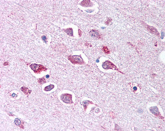 Anti-TLL2 antibody ALS11060 IHC of human brain, neurons and glia.