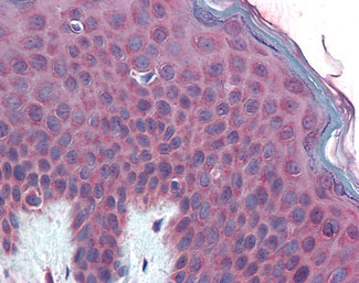 Anti-TM9SF3 antibody ALS10944 IHC of human skin.
