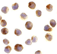 Immunocytochemistry of RAPTOR in L1210 cells with RAPTOR antibody at 10 µg/mL.