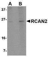 Western blot analysis of RCAN2 in 3T3 cell lysate with RCAN2 antibody at (A) 1 and (B) 2 µg/mL.