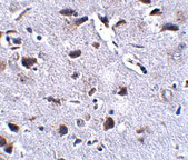 Immunohistochemistry of RCAN2 in mouse brain tissue with RCAN2 antibody at 2.5 µg/mL.