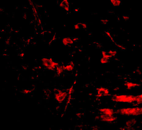 Immunofluorescence of RCAN2 in mouse brain tissue with RCAN2 antibody at 20 µg/mL.