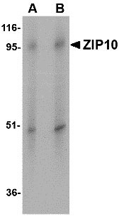Western blot analysis of ZIP10 in human spleen tissue lysate with ZIP10 antibody at (A) 1 and (B) 2 µg/mL.