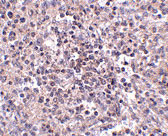 Immunohistochemistry of ZIP10 in human spleen tissue with ZIP10 antibody at 2.5 µg/mL.