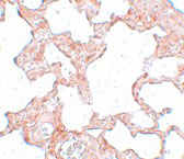 Immunohistochemistry of VLK in rat lung tissue with VLK antibody at 2.5 µg/mL.