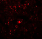 Immunofluorescence of RHBDD2 in Rat Lung cells with RHBDD2 antibody at 20 µg/mL.