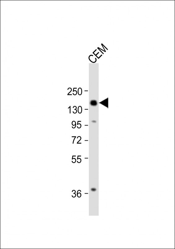 Anti-ATG2B Antibody (N-term) at 1:2000 dilution + CEM whole cell lysate Lysates/proteins at 20 µg per lane. Secondary Goat Anti-Rabbit IgG, (H+L), Peroxidase conjugated at 1/10000 dilution. Predicted band size : 232 kDa Blocking/Dilution buffer: 5% NFDM/TBST.