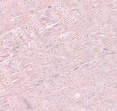 Immunohistochemistry of ADAMTSL5 in mouse skeletal muscle tissue with ADAMTSL5 antibody at 5 µg/mL.
