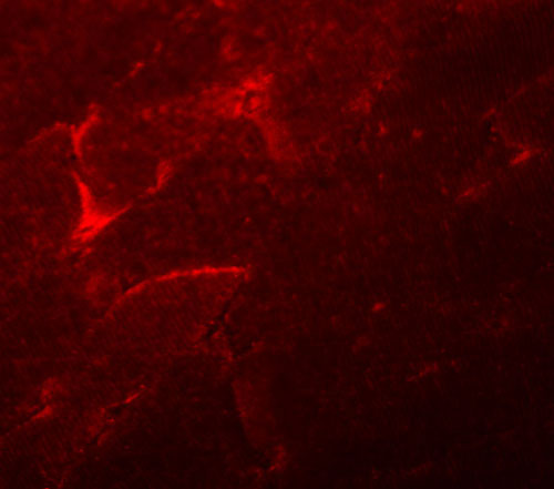 Immunofluorescence of ADAMTSL5 in mouse skeletal muscle tissue with ADAMTSL5 antibody at 20 µg/mL.