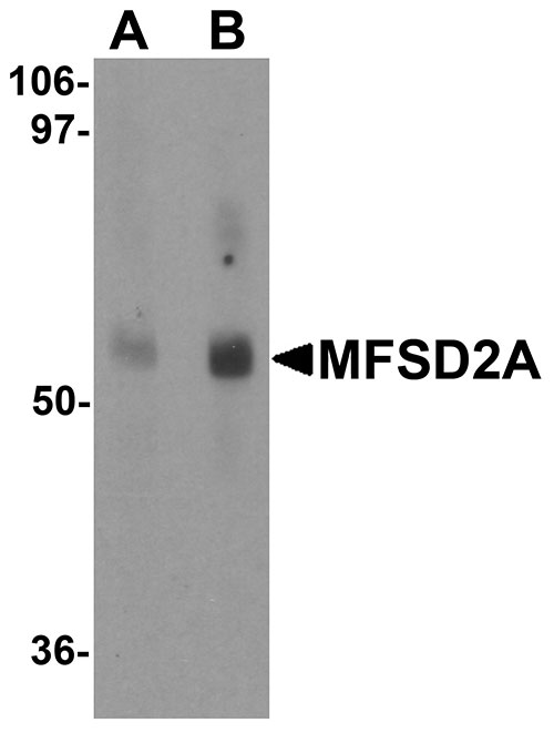 Western blot analysis of MFSD2A in rat lung tissue lysate with MFSD2A antibody at (A) 1 and (B) 2 µg/mL.