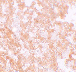 Immunohistochemistry of MFSD2A in rat lung tissue with MFSD2A antibody at 5 µg/mL.