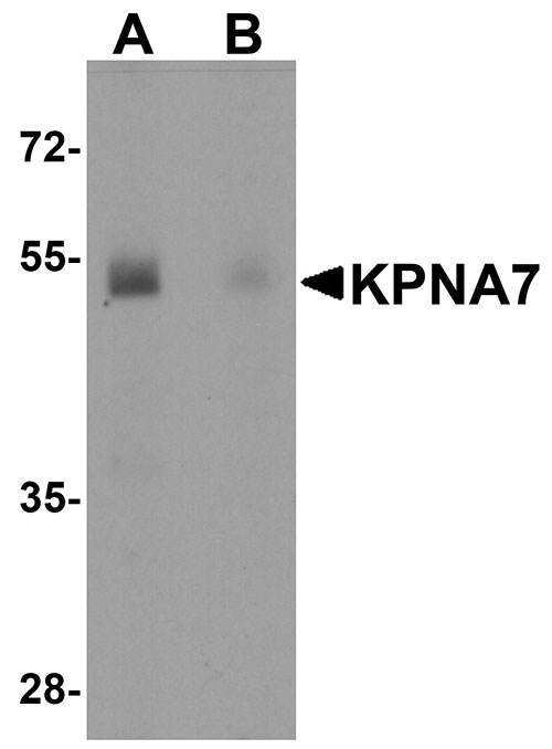 Western blot analysis of KPNA7 in human spleen with KPNA7 antibody at 1 µg/ml in (A) the absence and (B) the presence of blocking peptide.