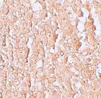 Immunohistochemistry of ZIP10 in human spleen tissue with ZIP10 antibody at 2.5 µg/mL.