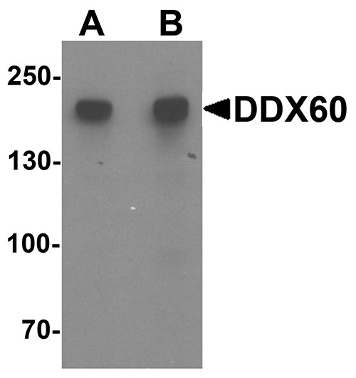 Western blot analysis of DDX60 in A20 cell lysate with DDX60 antibody at (A) 1 and (B) 2 µg/mL.
