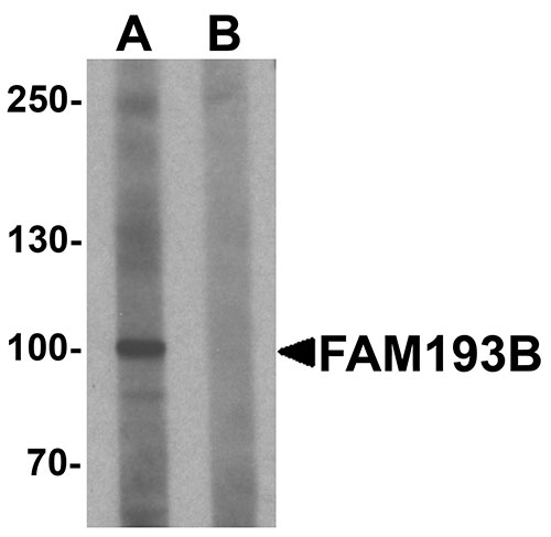 Western blot analysis of FAM193B in Jurkat cell lysate with FAM193B antibody at 1 µg/mL in (A) the absence and (B) the presence of blocking peptide.