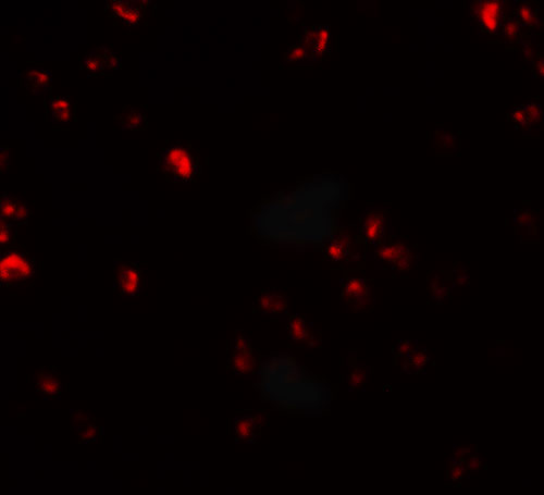 Immunofluorescence of FAM193B in Jurkat cells with FAM193B antibody at 20 µg/mL.