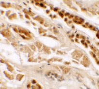 Immunohistochemistry of TTYH2 in human kidney tissue with TTYH2 antibody at 2.5 µg/mL.